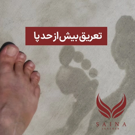 تعریق بیش از حد پا و دلایل آن